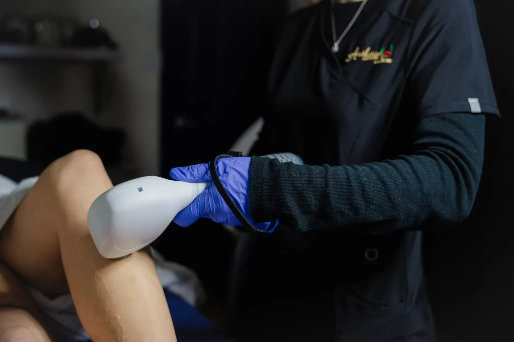 Hair removal with the Elysion-Pro